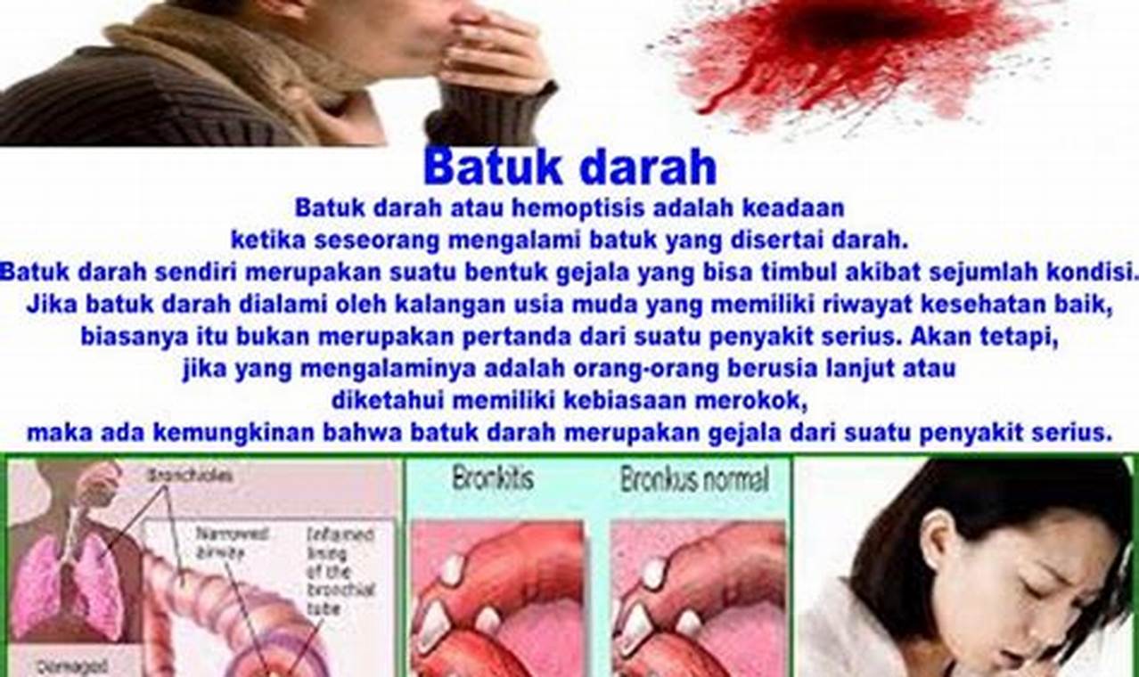 Cara Mengatasi Batuk Terus Menerus Cara Mengatasi Batuk Terus Menerus